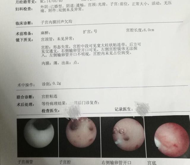 胎儿脐血流参数