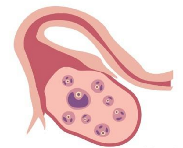 天津试管助孕宝宝